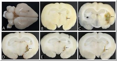 Minimally Invasive Surgery for ICH Evacuation Combined With Deferoxamine Treatment Increased Perihematomal Claudin-5 and ZO-1 Expression Levels and Decreased BBB Permeability in Rabbits